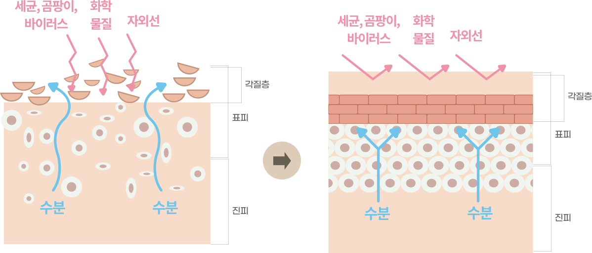 리쥬란 힐러 개선 이미지