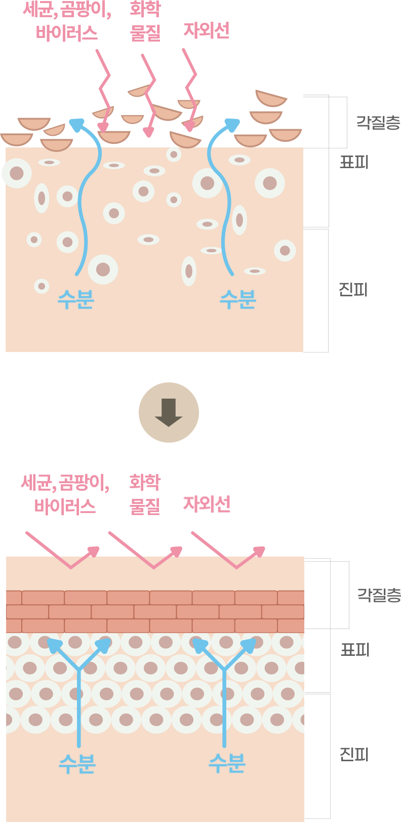 리쥬란 힐러 개선 이미지