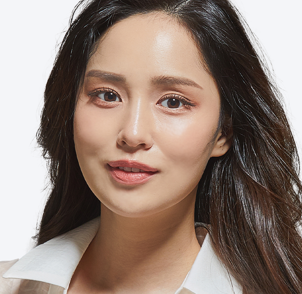 눈재수술 여성 모델