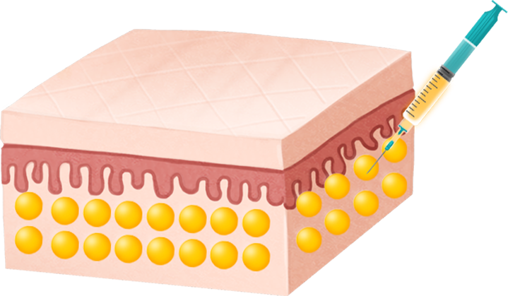 생착률 이미지